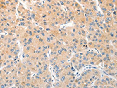 RPN1 Antibody