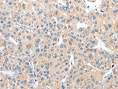 RPN1 Antibody