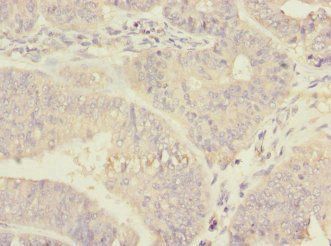 RPN2 Antibody