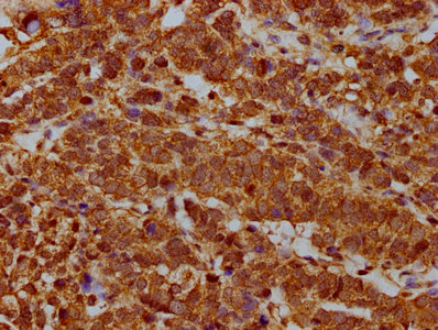 RPP38 antibody