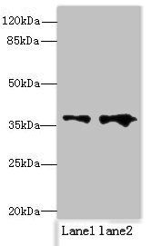 RPRD1B antibody