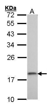 ribosomal protein S10 Antibody