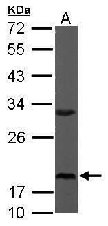 ribosomal protein S10 Antibody