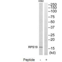 RPS19 antibody