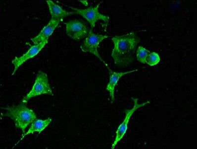 RPS2 Antibody