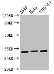 RPS2 Antibody