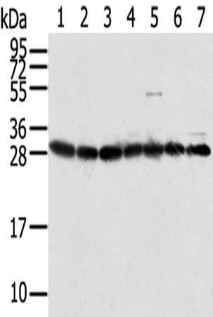RPS3 Antibody