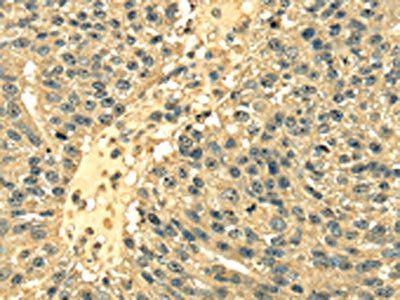 RPS3 Antibody