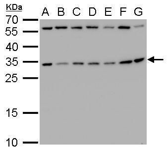 ribosomal protein S3A Antibody