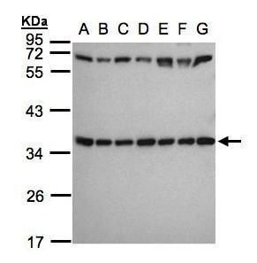 ribosomal protein S3A Antibody