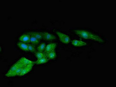 RPS4Y1 Antibody
