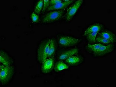RPS5 Antibody