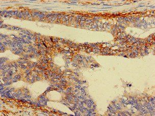 RPS5 Antibody