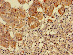 RPS5 Antibody