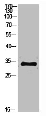 RPS6 Antibody