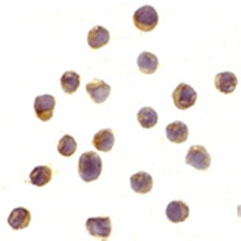 RPS6K1 Antibody