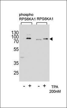 RPS6KA1 (phospho-Thr359) antibody