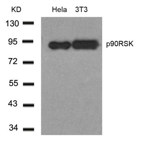 RPS6KA1 (Ab-348) antibody