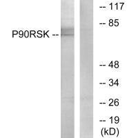 RPS6KA1 (Ab-573) antibody