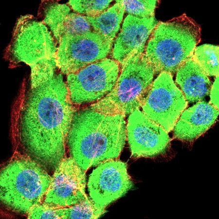 RPS6KA2 Antibody