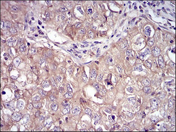 RPS6KA2 Antibody