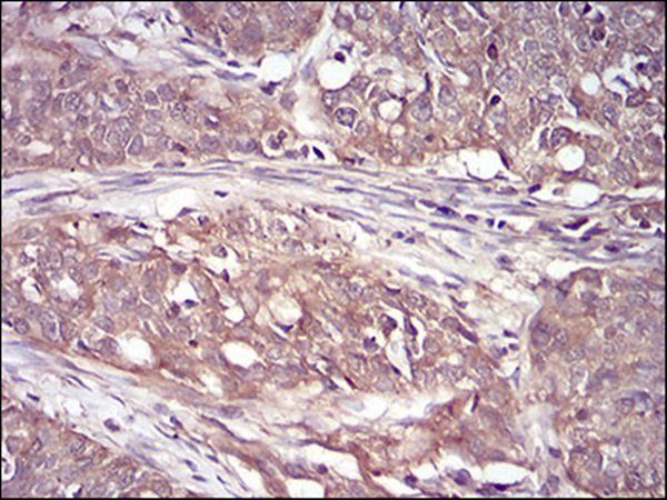 RPS6KA2 Antibody