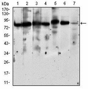 RPS6KA2 Antibody