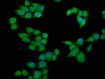 RPS6KA2 antibody