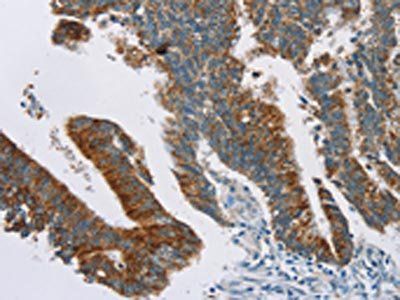 RPS6KA2 antibody