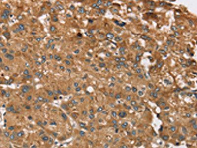 RPS6KA2 Antibody