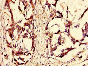 RPS6KA4 antibody