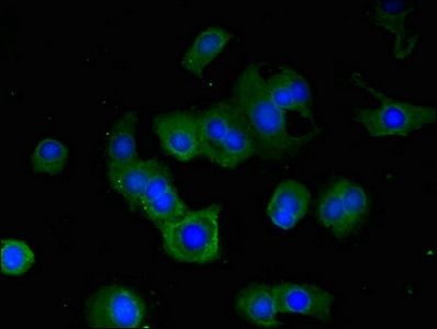 RPS6KA5 Antibody