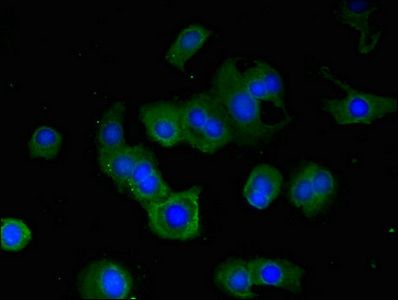 RPS6KA5 antibody