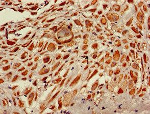 RPS6KA5 Antibody
