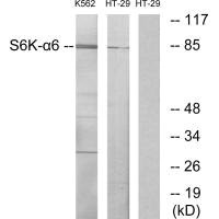RPS6KA6 antibody