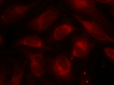 RPS6KB1 Antibody