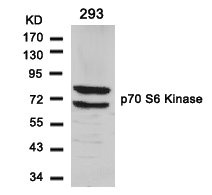 RPS6KB1 (Ab-411) antibody