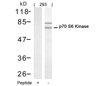 RPS6KB1 Antibody