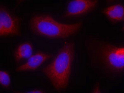 RPS6KB1 Antibody