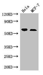 RPS6KB1 Antibody