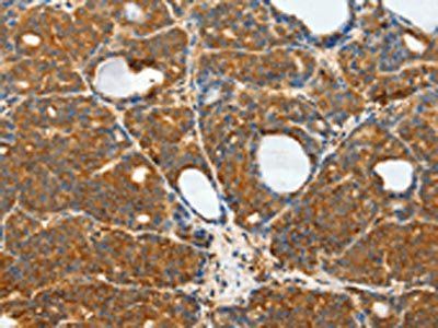 RPS6KB1 Antibody