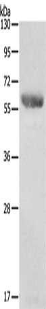 RPS6KB1 Antibody