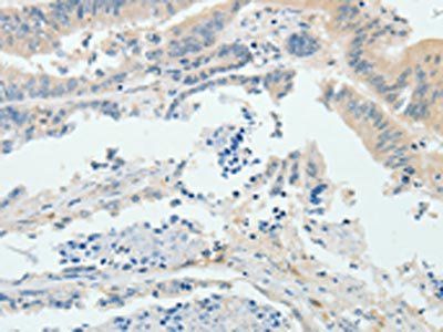 RPS6KB1 Antibody