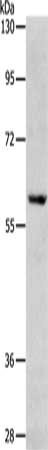 RPS6KB1 Antibody