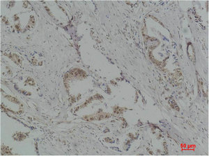 RPS6KB1 Antibody