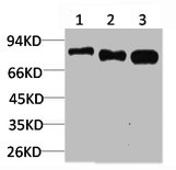 RPS6KB1 Antibody