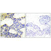 RPS6KB1 Antibody