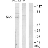 RPS6KB1 Antibody