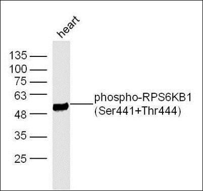 RPS6KB1 (phospho-Thr421+Ser424) antibody