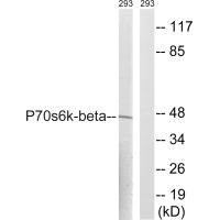 RPS6KB2 (Ab-423) antibody